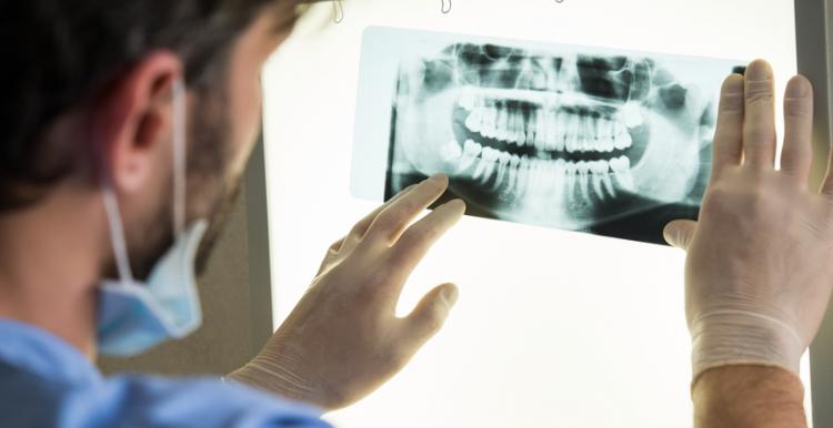 Dentist looking at a dental x-ray Dentist looking at a dental x-ray